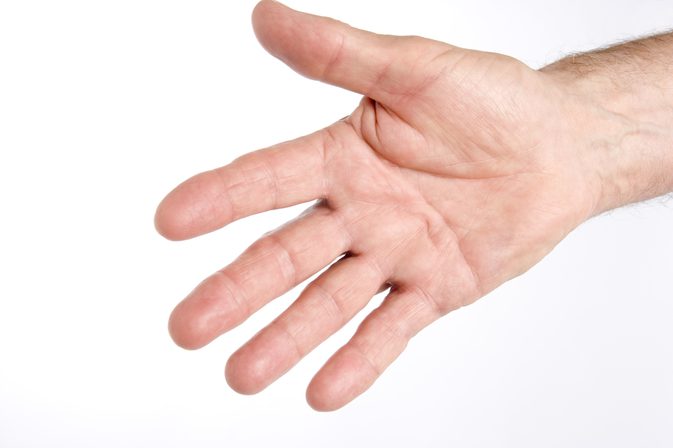 Sådan stopper du plukning på huden på fingrene