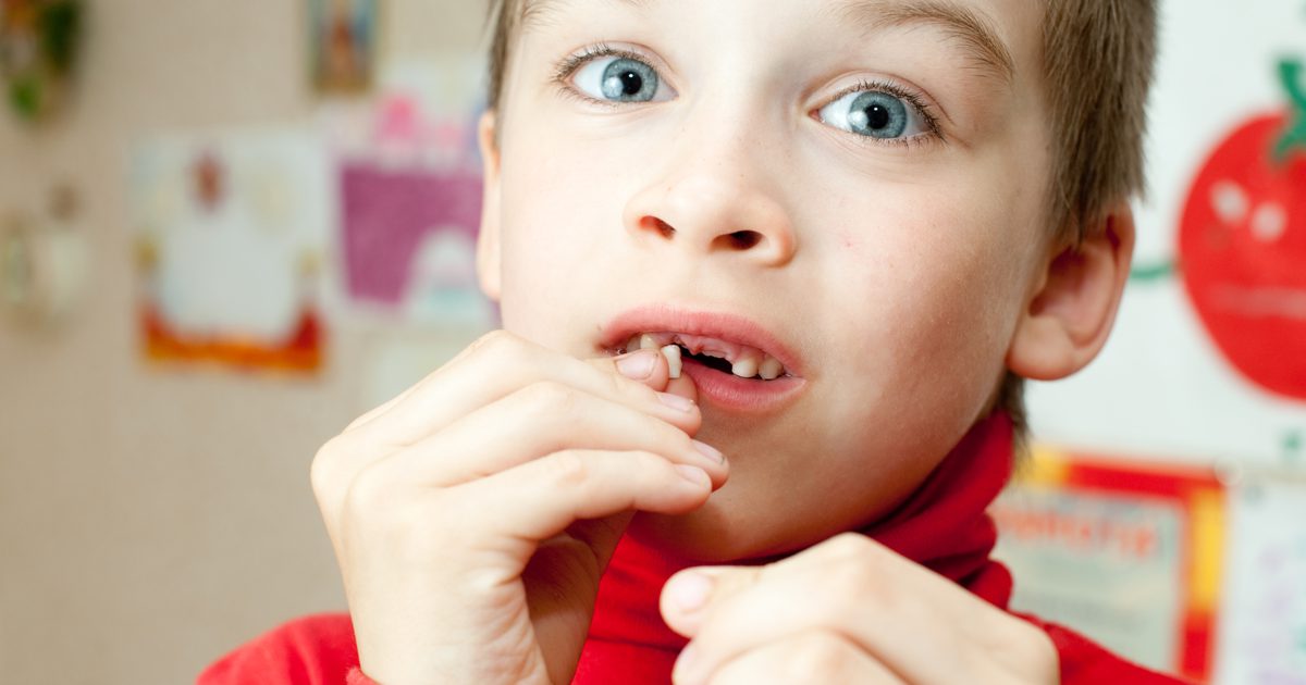 बच्चों में ढीला दांत दर्द