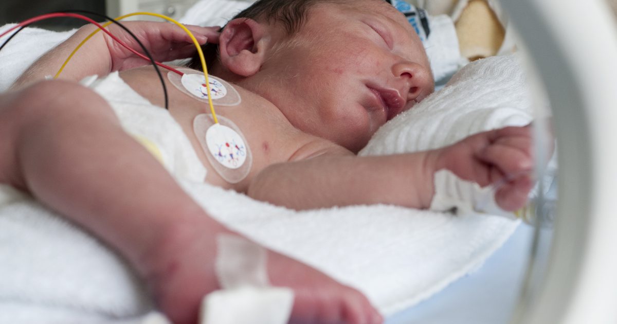 Коефициенти на оцеляване за недоносено бебе