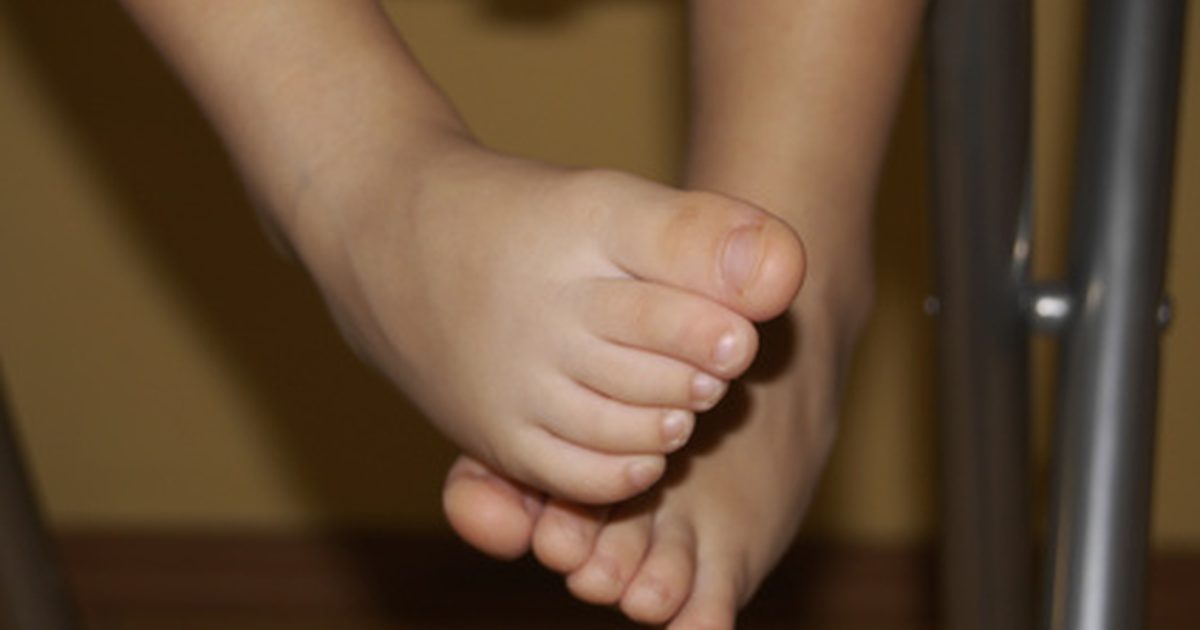 Toddler Foot Problemer