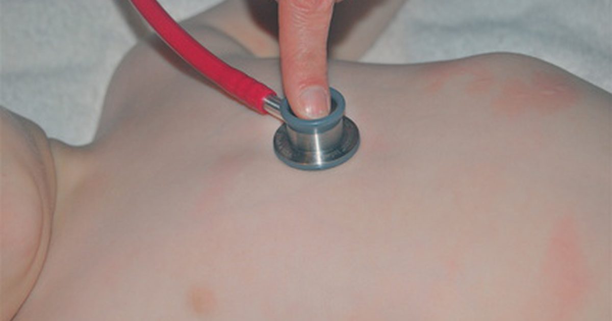 En spädbarn med utslag på bröstet och baksidan
