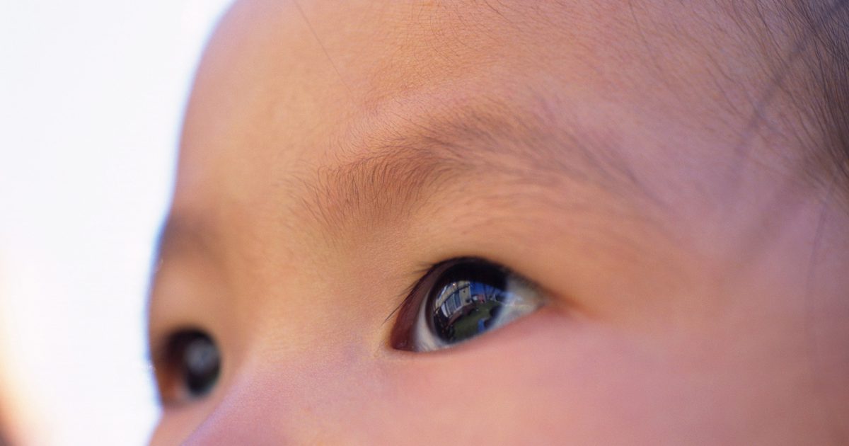 Vodnaté oči u kojenců