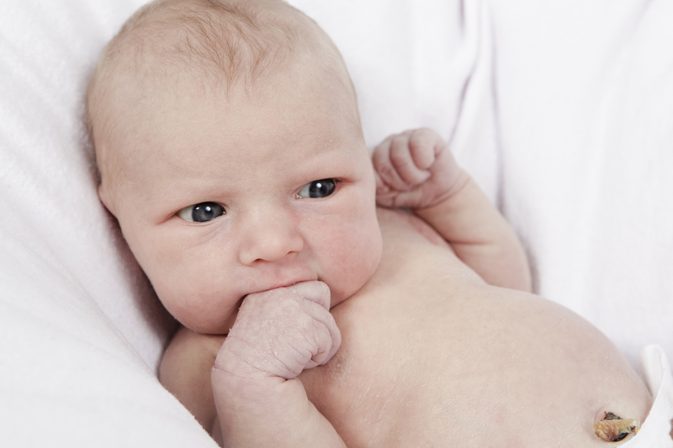 एक शिशु के पेट बटन समस्या के साथ आप क्या करते हैं?