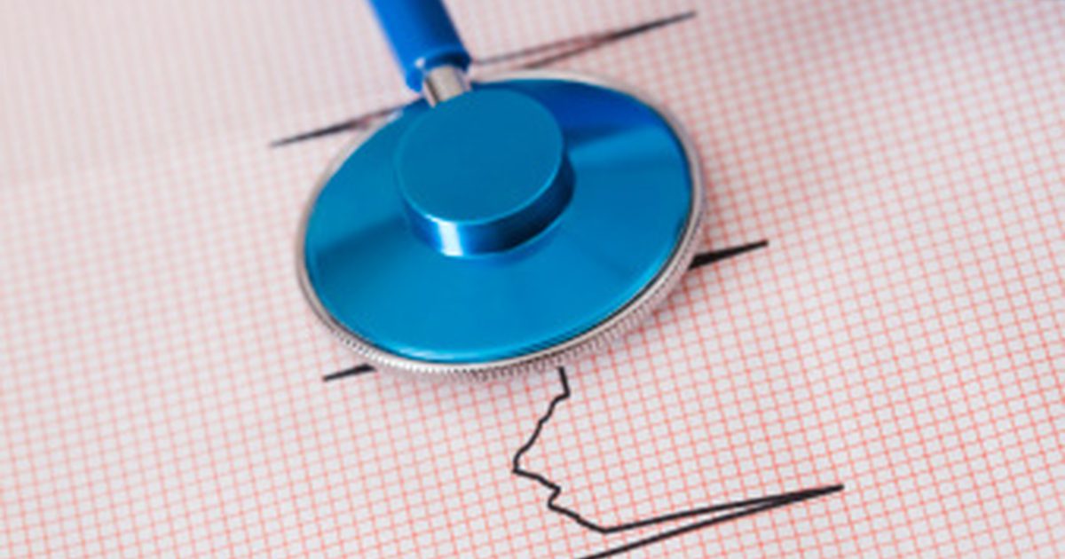 Отсъствия и паузи по време на сърдечната честота