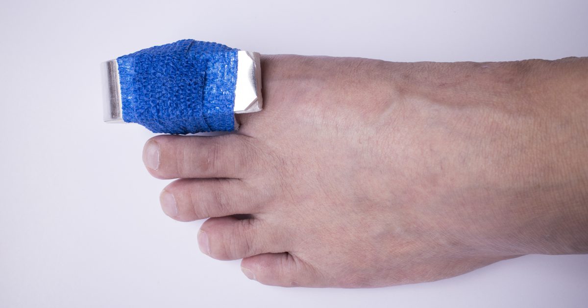 يمكنك المشي إذا تم كسر إصبع قدمك الكبير؟