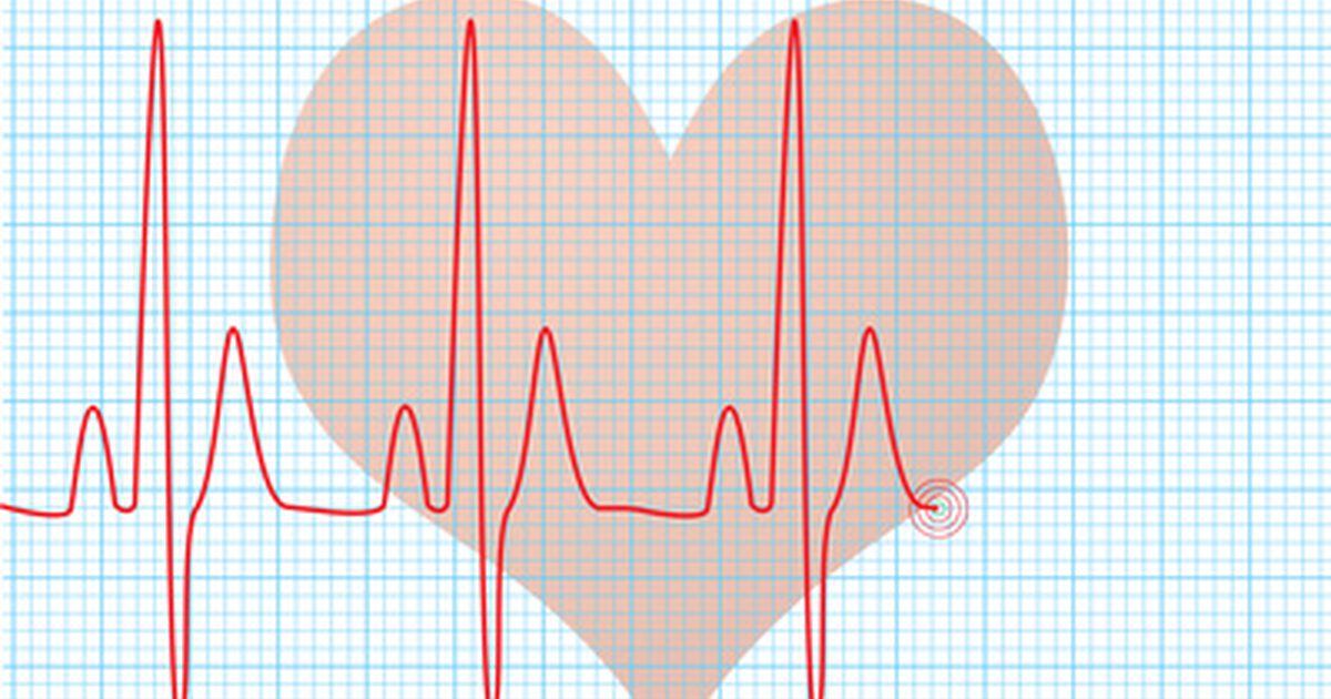 Årsaker til hjertefrekvensendringer