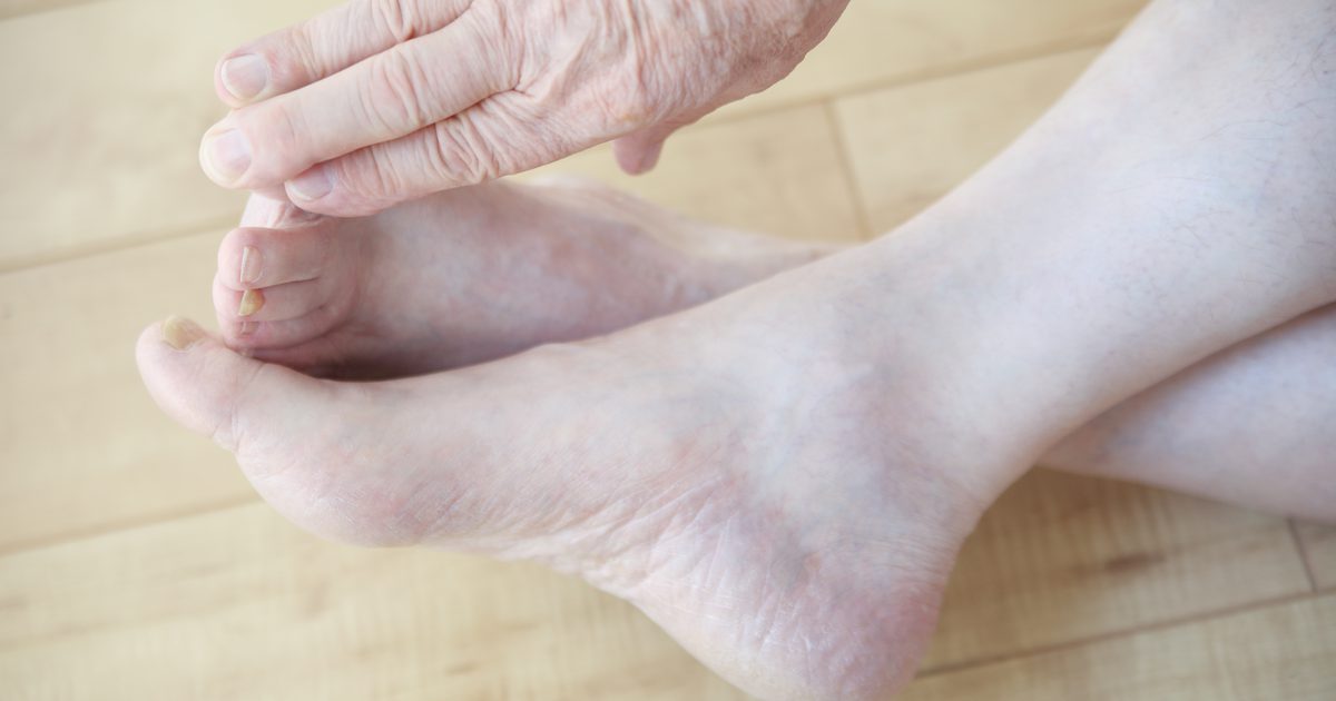Cvičenie na posilnenie prstov a nohy