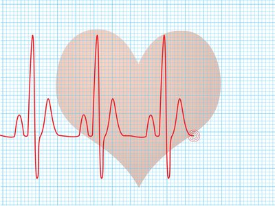 Faktorer der påvirker hjertefrekvensen