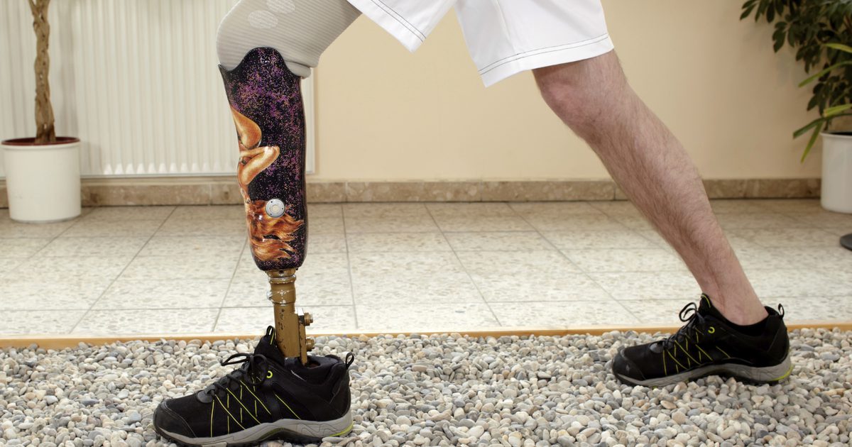 Hvordan lære å gå på et prostetisk ben