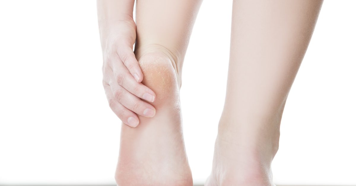 Jak wzmocnić mięśnie łuku stopy