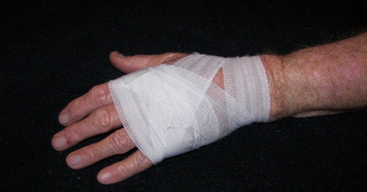 Sådan pakker du en sprained hånd i en ACE bandage
