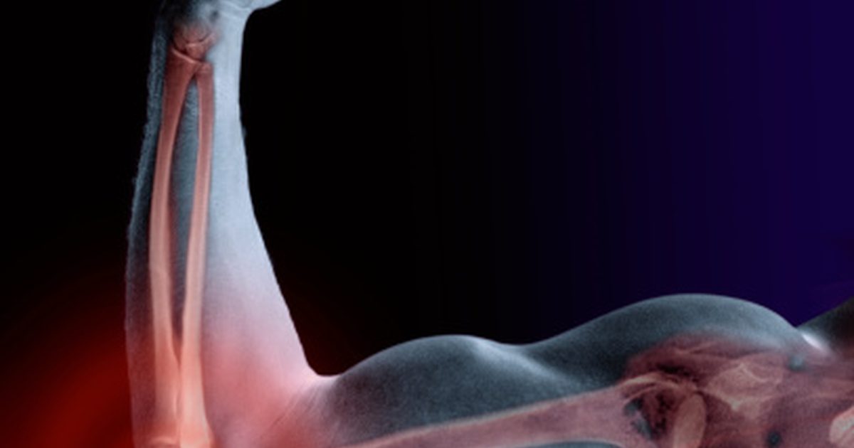 Jakie są przyczyny zmęczenia mięśni ramion?