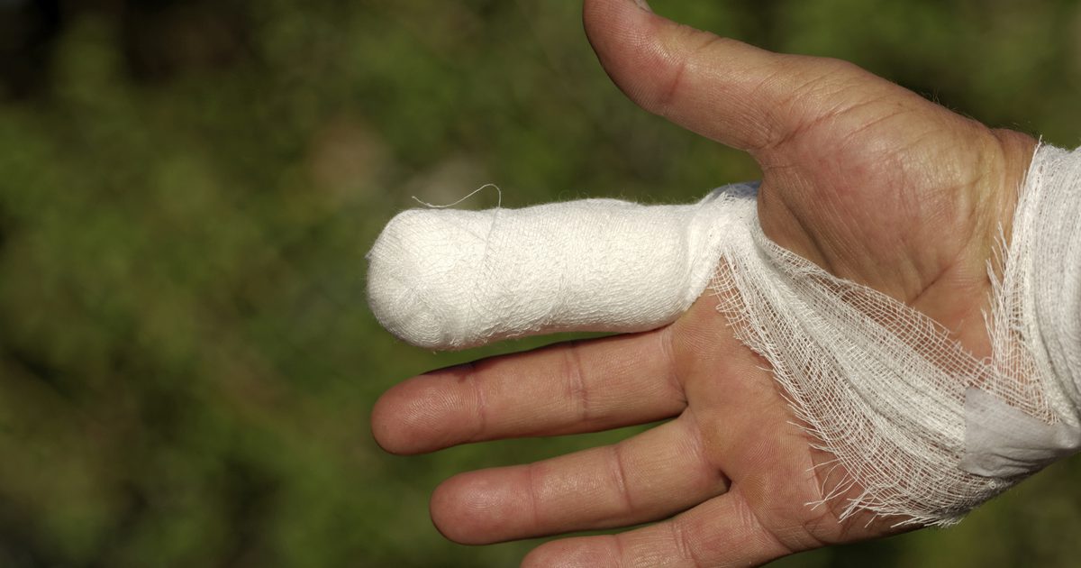 Kaj je obnovitveni čas za zlomljen prst v baseball predvajalnikih?