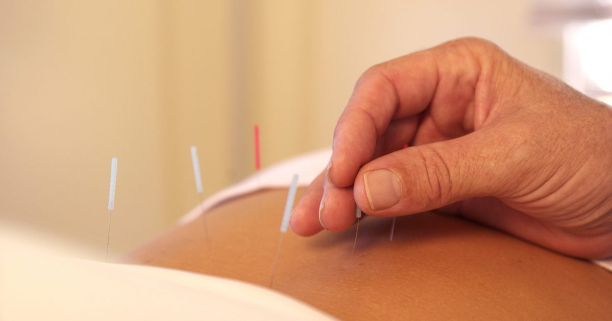Funktioniert Akupunktur zur Gewichtsreduktion?
