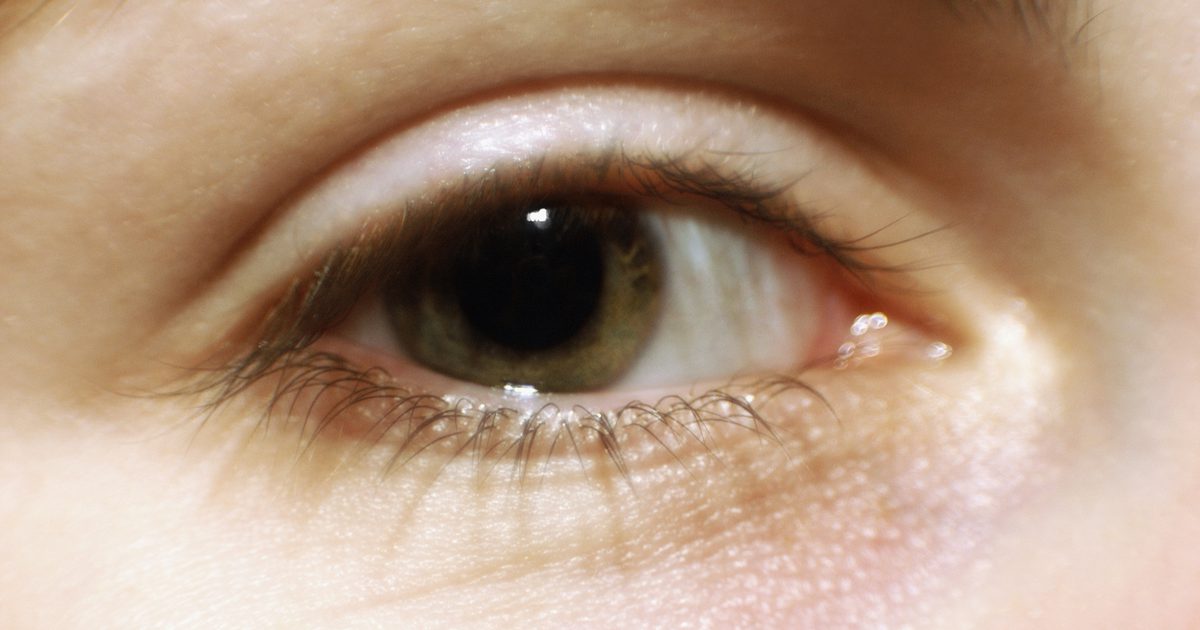 Øjenvipper tab forårsager