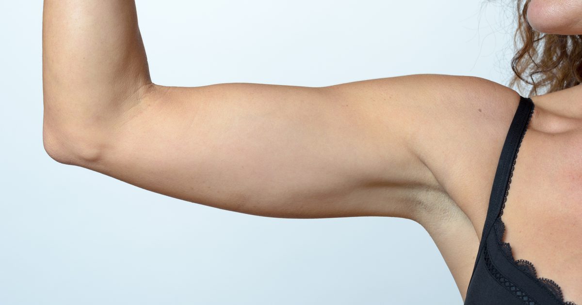 Hvordan få fett i armene og benene